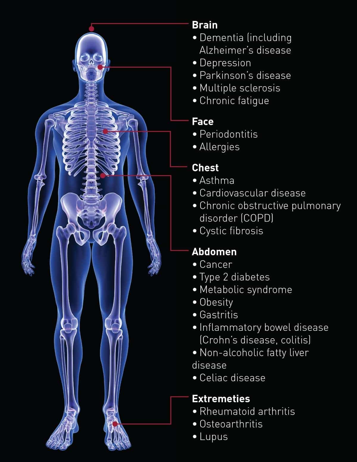Skeleton showing every part of the body that low-grade inflammation affects
